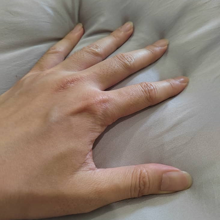 giraf® Silver & Hyaluron Mulberry Silk Pillowcase (Custom Fit)